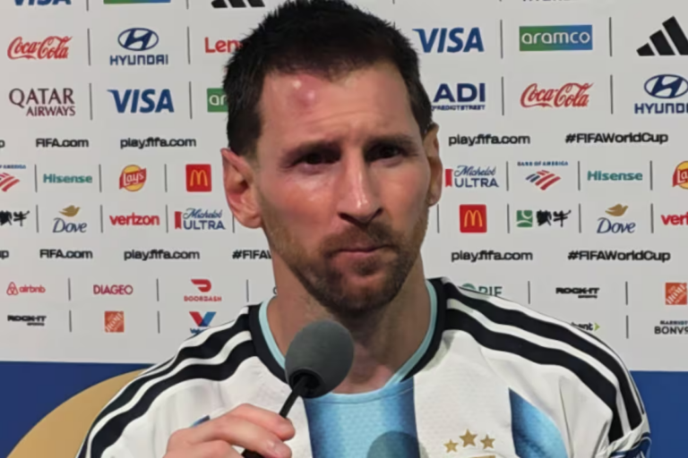 el-chichon-de-messi-tras-el-partido-ante-cabo-OHFXCHOLEJHD5BJFHLQNKZZ5QQ